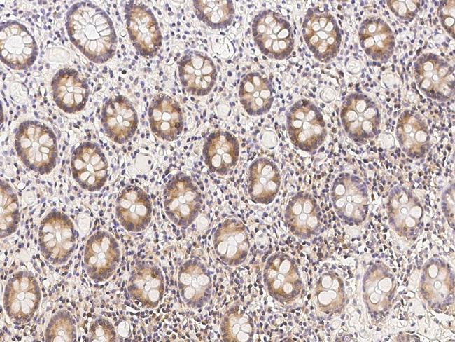 METAP2 Antibody in Immunohistochemistry (Paraffin) (IHC (P))