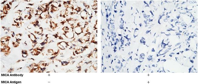 MICA Antibody in Immunohistochemistry (Paraffin) (IHC (P))