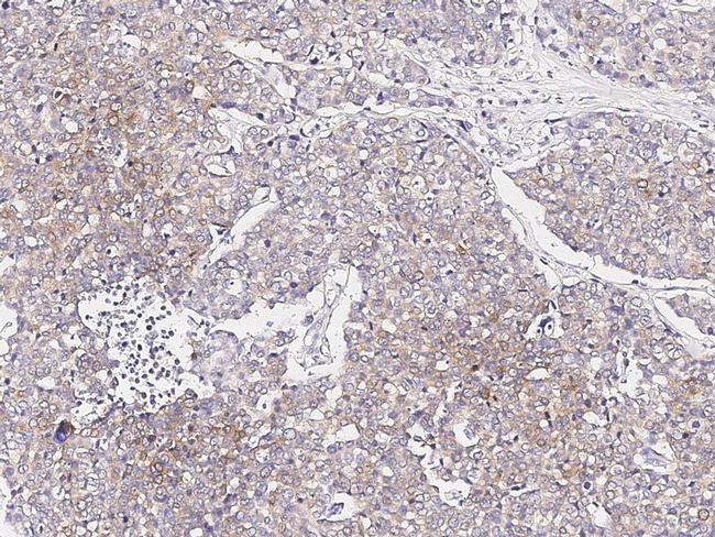 Melan-A Antibody in Immunohistochemistry (Paraffin) (IHC (P))