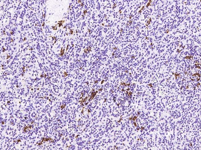 MZB1 Antibody in Immunohistochemistry (Paraffin) (IHC (P))