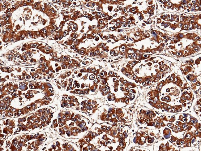 NBL1 Antibody in Immunohistochemistry (Paraffin) (IHC (P))