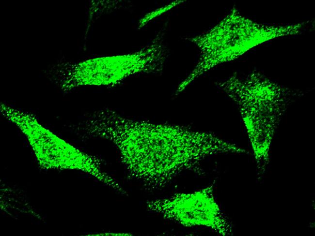 NCAPH Antibody in Immunocytochemistry (ICC/IF)