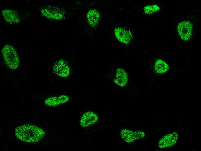 NCoR2 Antibody in Immunocytochemistry (ICC/IF)