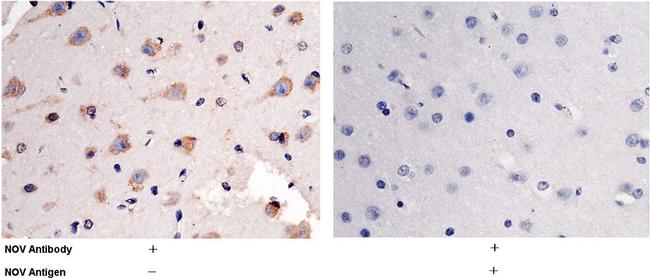 NOV Antibody in Immunohistochemistry (Paraffin) (IHC (P))