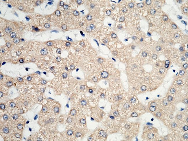 PDI Antibody in Immunohistochemistry (Paraffin) (IHC (P))