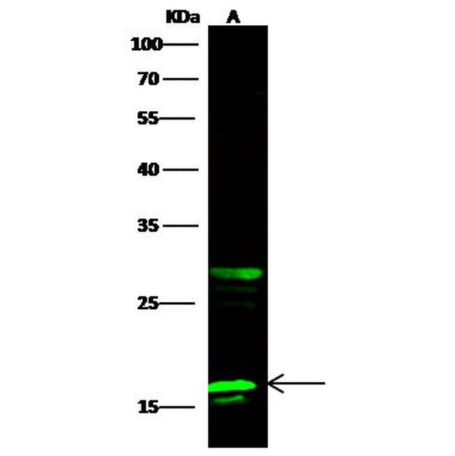 PFDN2 Antibody in Western Blot (WB)