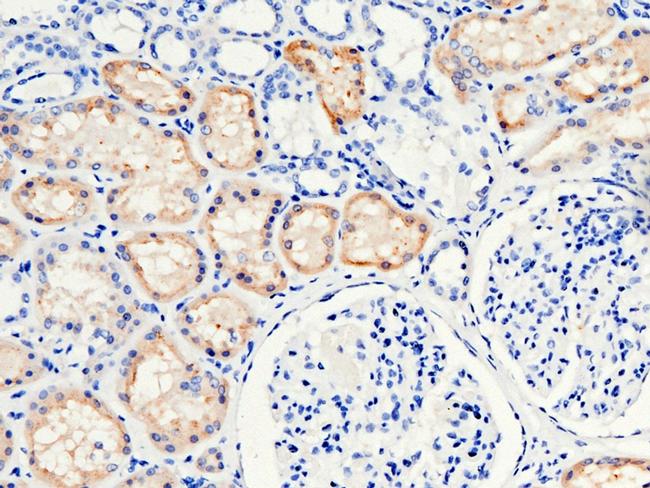 RBP4 Antibody in Immunohistochemistry (Paraffin) (IHC (P))