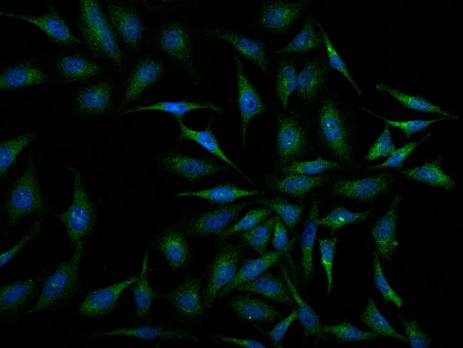 Periostin Antibody in Immunocytochemistry (ICC/IF)