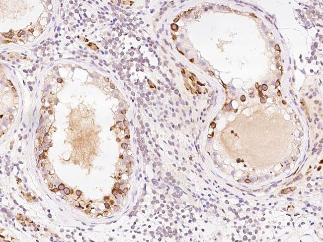 PPP2R1B Antibody in Immunohistochemistry (Paraffin) (IHC (P))