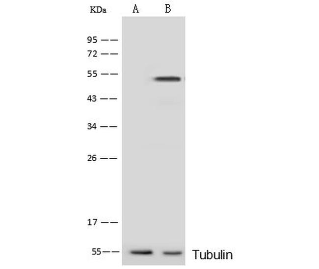 PRKAR1A Antibody in Western Blot (WB)