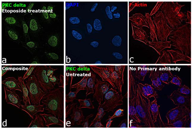 PKC delta Antibody in Immunocytochemistry (ICC/IF)