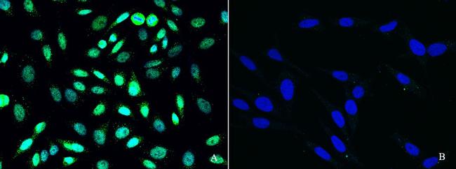 PRMT6 Antibody in Immunocytochemistry (ICC/IF)