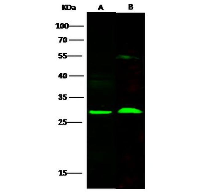 SNAP25 Antibody in Western Blot (WB)