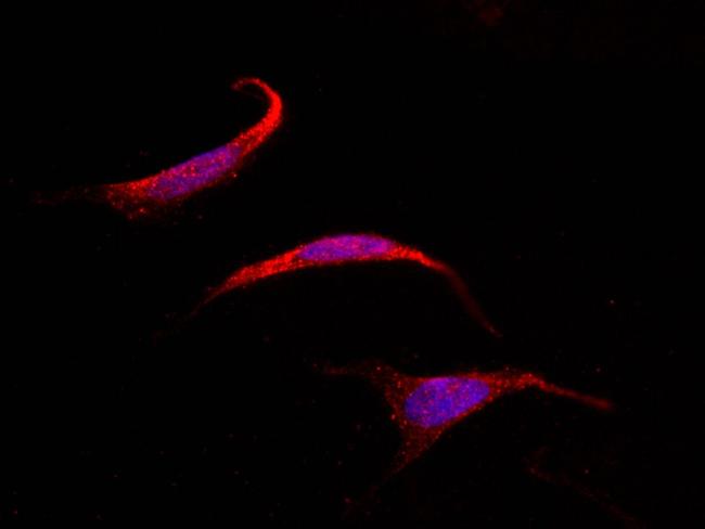 SOCS4 Antibody in Immunocytochemistry (ICC/IF)