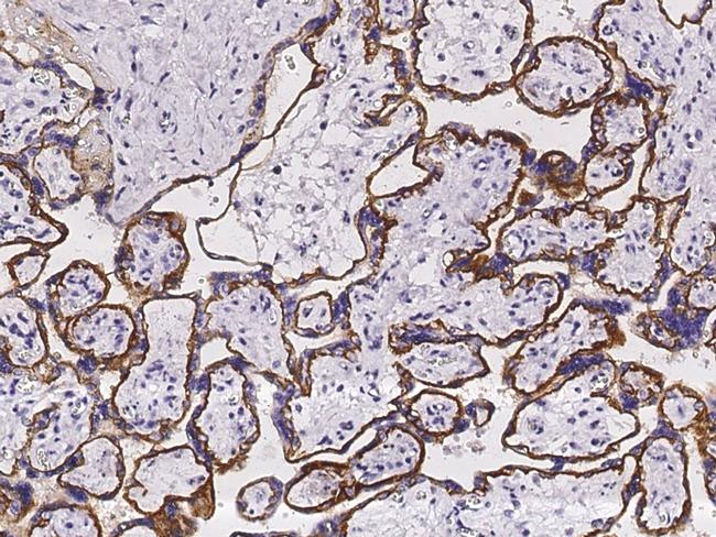 TROP2 Antibody in Immunohistochemistry (Paraffin) (IHC (P))