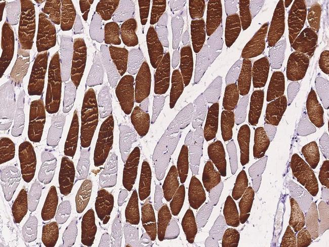 TAZ Antibody in Immunohistochemistry (Paraffin) (IHC (P))