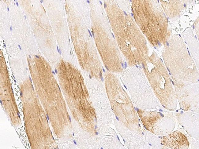 TET1 Antibody in Immunohistochemistry (Paraffin) (IHC (P))