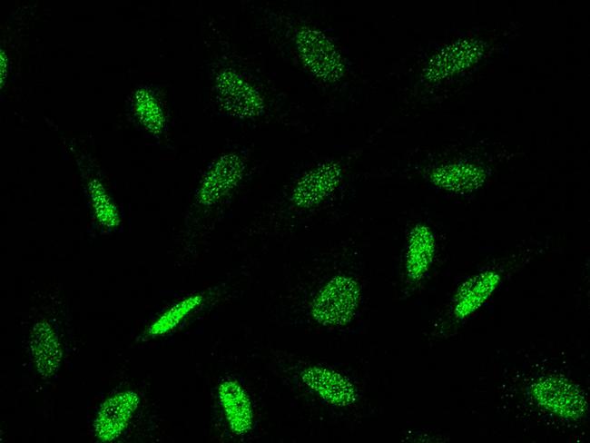 TLE1 Antibody in Immunocytochemistry (ICC/IF)