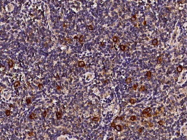 CD30 Antibody in Immunohistochemistry (Paraffin) (IHC (P))