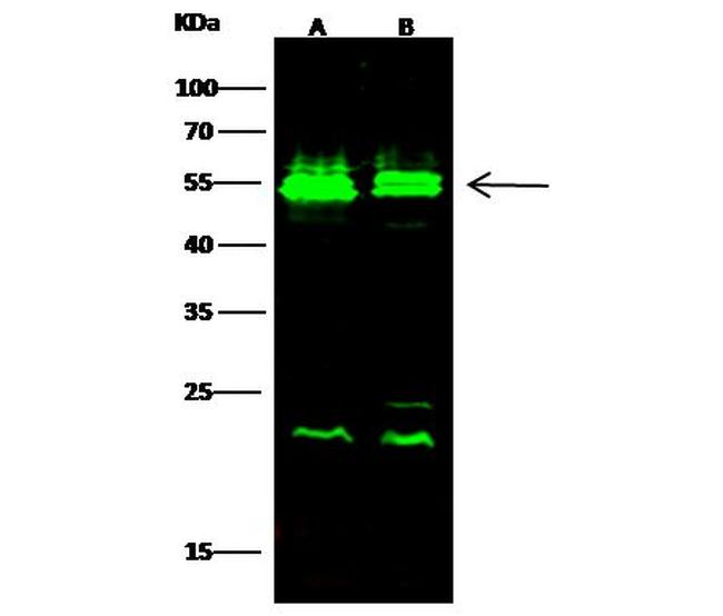 VRK1 Antibody in Western Blot (WB)