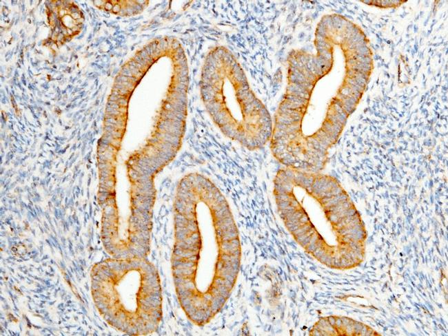 WFDC2 Antibody in Immunohistochemistry (Paraffin) (IHC (P))