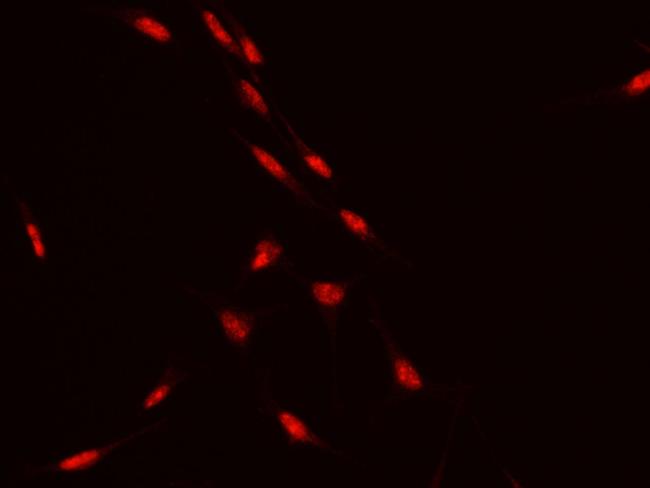 ATF Antibody in Immunocytochemistry (ICC/IF)