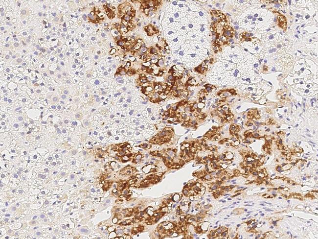 CaMKII alpha Antibody in Immunohistochemistry (Paraffin) (IHC (P))