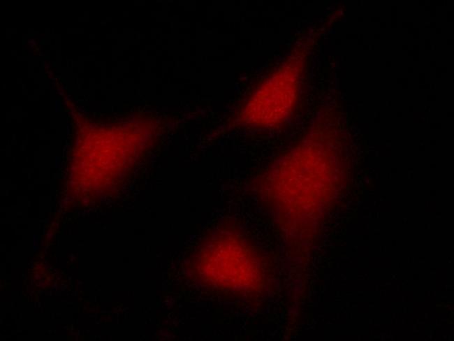 PRMT4 Antibody in Immunocytochemistry (ICC/IF)