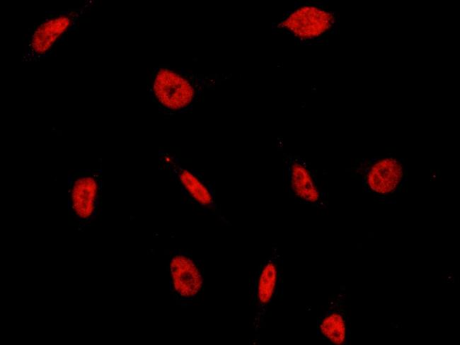 HP1 beta Antibody in Immunocytochemistry (ICC/IF)