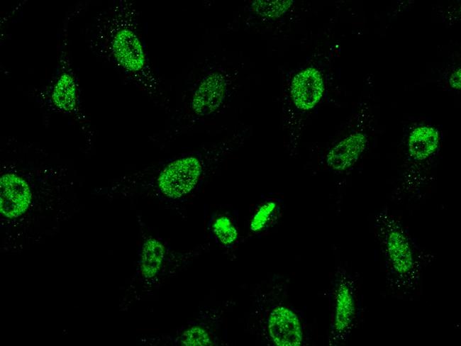 CHD4 Antibody in Immunocytochemistry (ICC/IF)