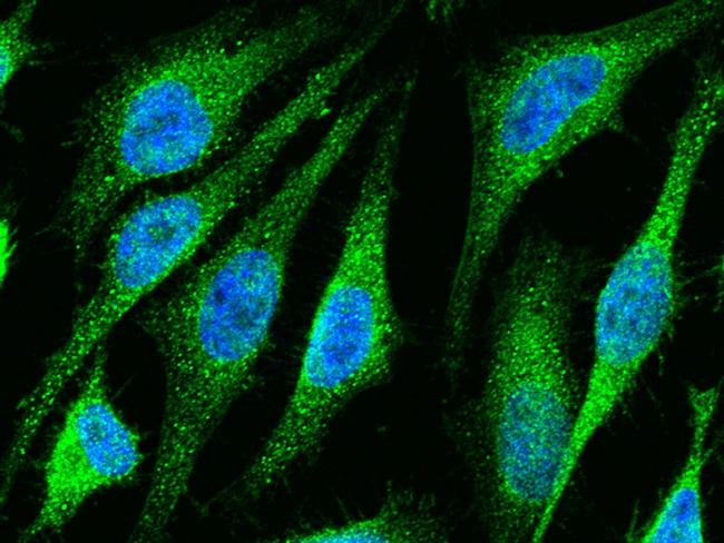 ETS1 Antibody in Immunocytochemistry (ICC/IF)