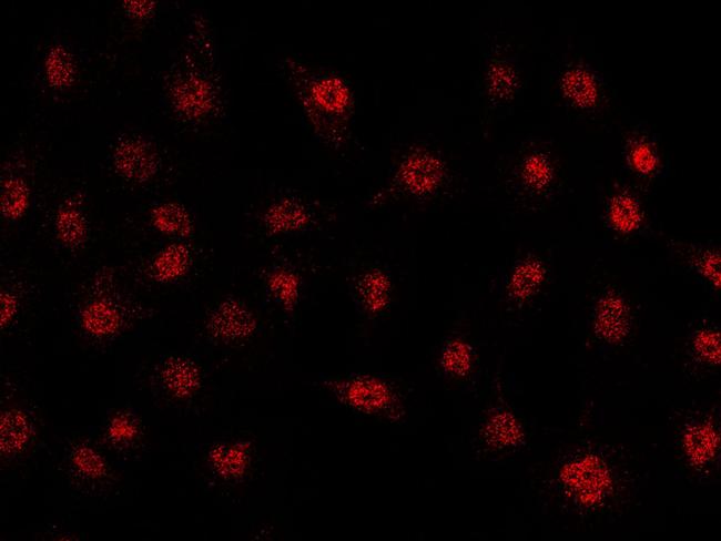 Fra1 Antibody in Immunocytochemistry (ICC/IF)