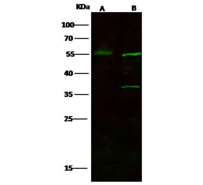 FOXA1 Antibody in Western Blot (WB)