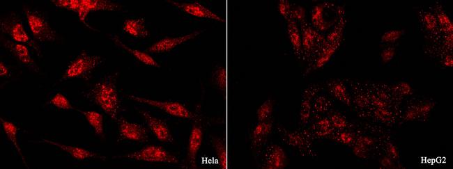 GLI1 Antibody in Immunocytochemistry (ICC/IF)