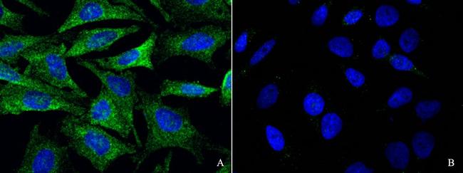 GluR6 Antibody in Immunocytochemistry (ICC/IF)