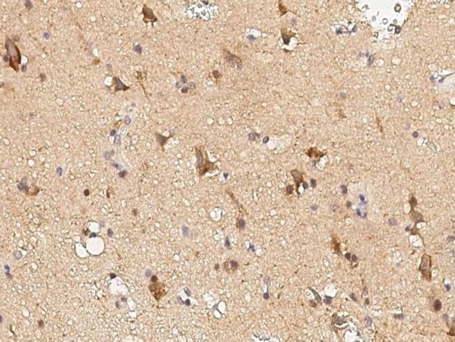 mGluR5 Antibody in Immunohistochemistry (Paraffin) (IHC (P))