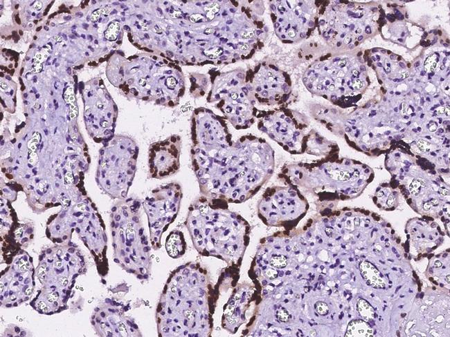 HMGB3 Antibody in Immunohistochemistry (Paraffin) (IHC (P))