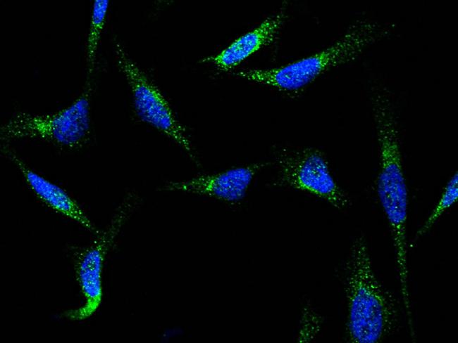 CD18 Antibody in Immunocytochemistry (ICC/IF)