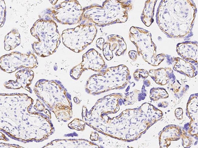 CD104 Antibody in Immunohistochemistry (Paraffin) (IHC (P))