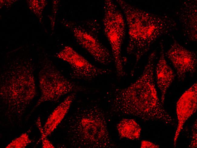 JMJD1A Antibody in Immunocytochemistry (ICC/IF)