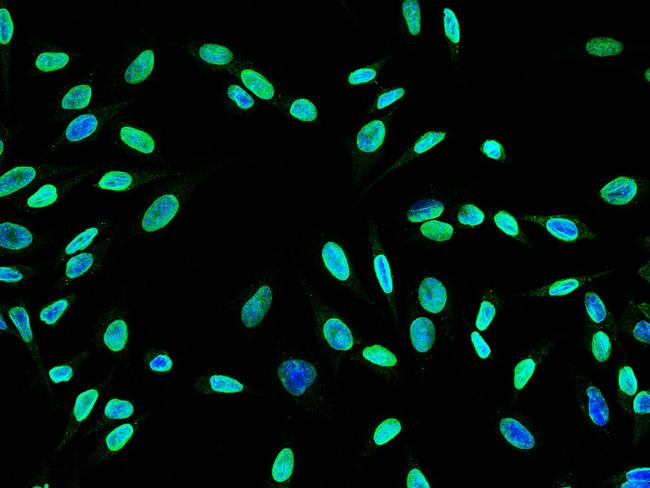 MEK5 Antibody in Immunocytochemistry (ICC/IF)