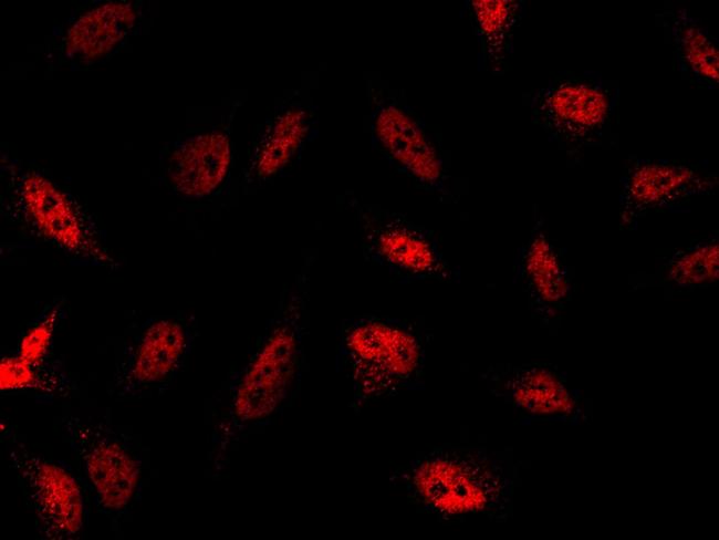 JNK1 Antibody in Immunocytochemistry (ICC/IF)