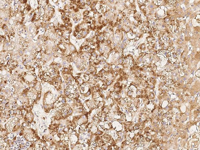 MSI1 Antibody in Immunohistochemistry (Paraffin) (IHC (P))