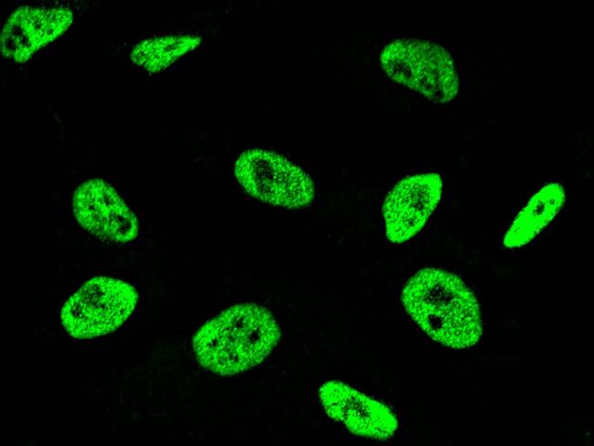 NME1 Antibody in Immunocytochemistry (ICC/IF)