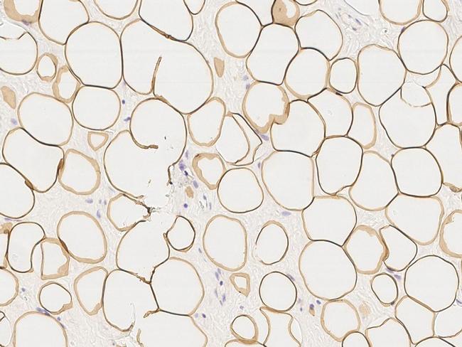 Perilipin 1 Antibody in Immunohistochemistry (Paraffin) (IHC (P))