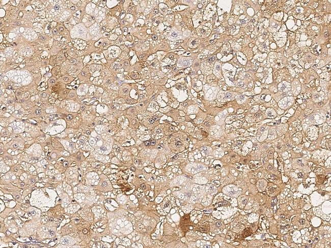 SMAD7 Antibody in Immunohistochemistry (Paraffin) (IHC (P))