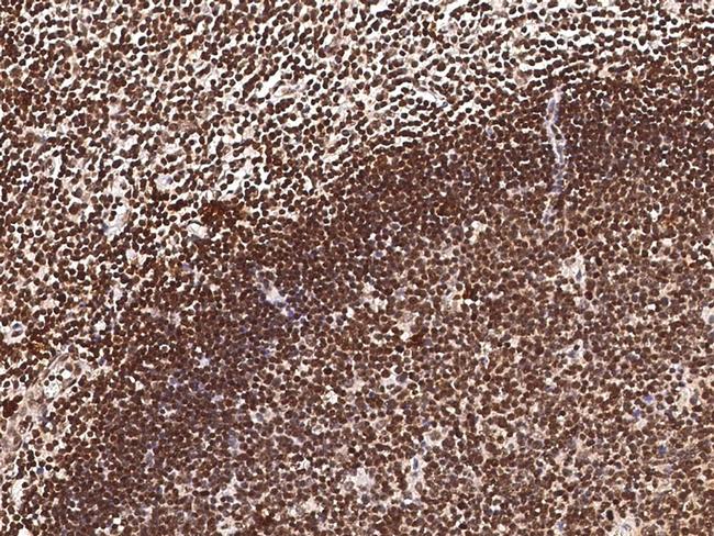 DP1 Antibody in Immunohistochemistry (Paraffin) (IHC (P))