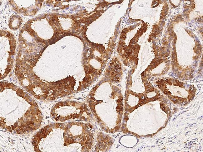 TNRC6A Antibody in Immunohistochemistry (Paraffin) (IHC (P))