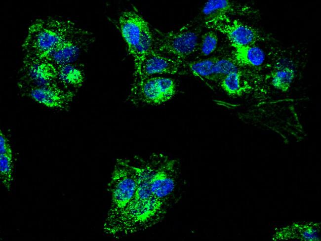 CPT2 Antibody in Immunocytochemistry (ICC/IF)