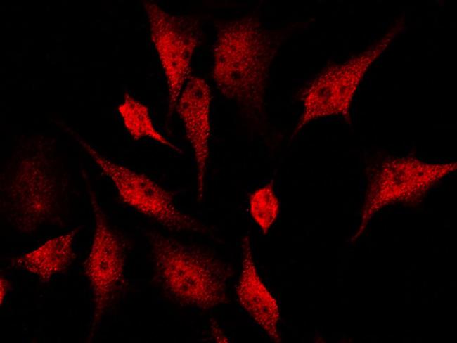 AMPK alpha-1 Antibody in Immunocytochemistry (ICC/IF)